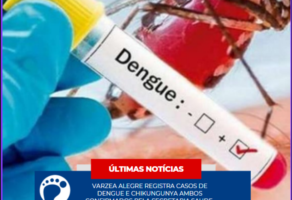 Capturar